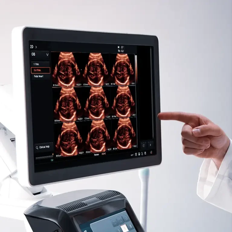 ultrasongrafi